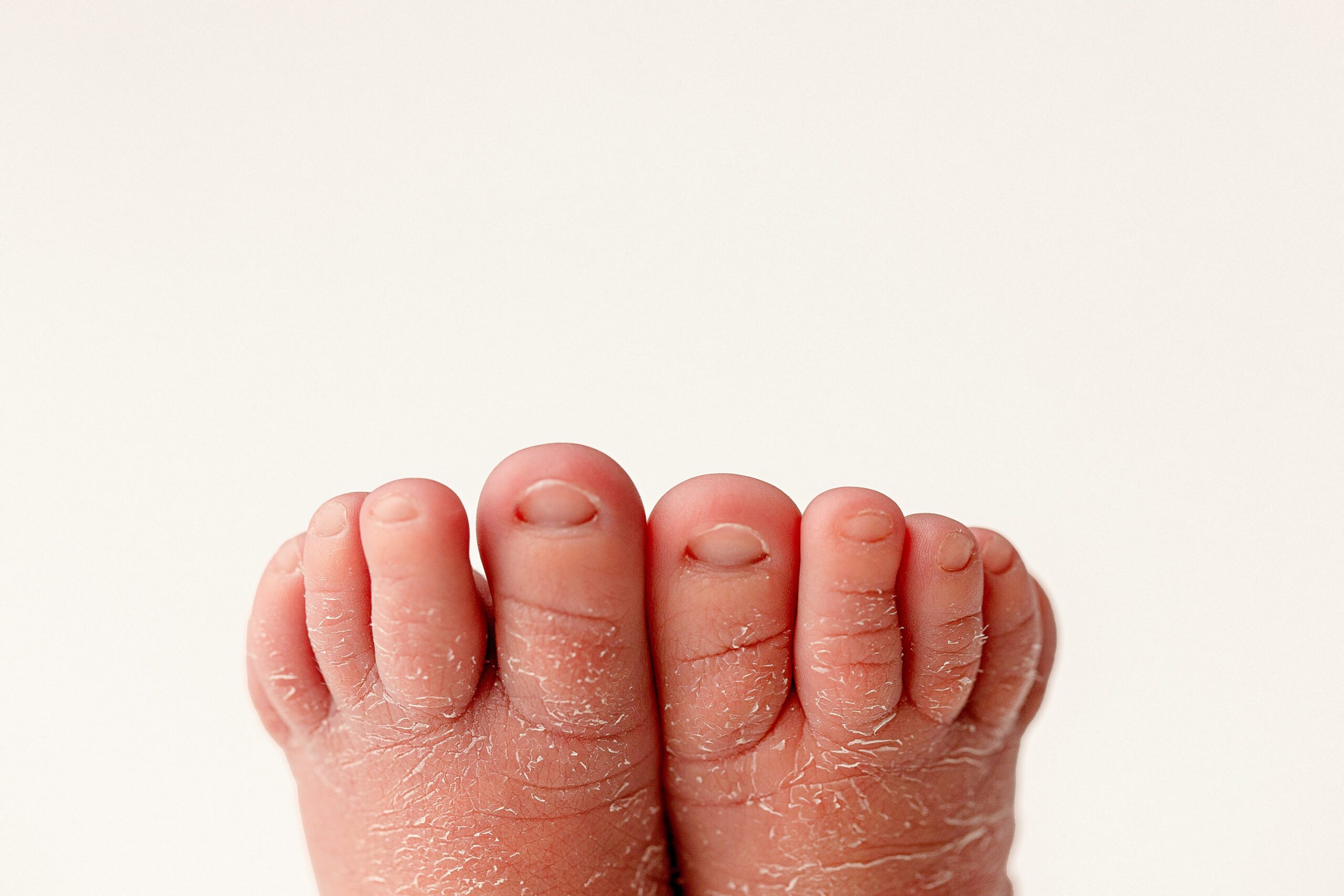 Newborn Photography, Details, Macro, Toes, Baby Feet, Close up